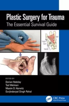 Image of Plastic Surgery for TraumaThe Essential Survival Guide
