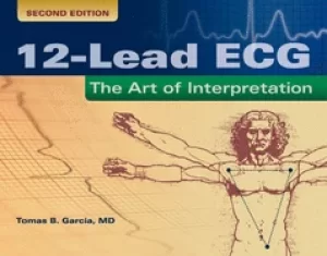 Image of 12 lead ecg the art of interpretation