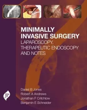 Image of Minimally Invasive SurgeryLaparoscopy Therapeutic Endoscopy and NOTES