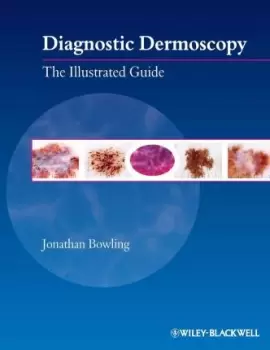 Image of Diagnostic Dermoscopy by Jonathan Bowling