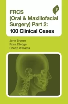 Image of FRCS (Oral & Maxillofacial Surgery) Part 2 : 100 Clinical Cases