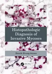 Image of Histopathologic Diagnosis of Invasive Mycoses
