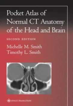 Image of Pocket Atlas of Normal Ct Anatomy of the Head and Brain by Michelle M. Smith Book