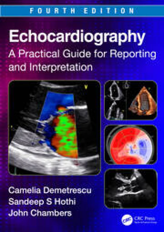 Image of Echocardiography : A Practical Guide for Reporting and Interpretation Paperback / softback