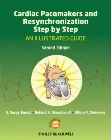 Image of Cardiac Pacemakers and Resynchronization Step by Step : An Illustrated Guide
