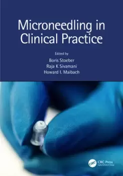 Image of Microneedling in Clinical Practice