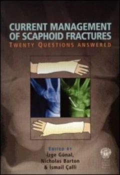 Image of Current management of scaphoid fractures by Izge Gnal