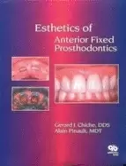 Image of esthetics of anterior fixed prosthodontics