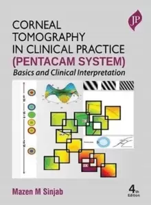Image of Corneal Tomography in Clinical Practice (Pentacam System)