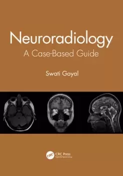 Image of NeuroradiologyA Case-Based Guide