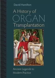 Image of A History of Organ Transplantation : Ancient Legends to Modern Practice