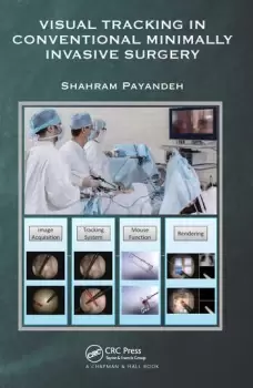 Image of Visual Tracking in Conventional Minimally Invasive Surgery