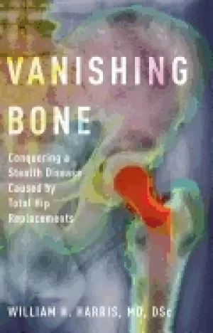 Image of vanishing bone conquering a stealth disease caused by total hip replacement