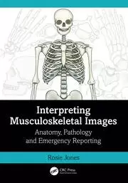 Image of Interpreting Musculoskeletal Images Anatomy Pathology and Emergency Reporting