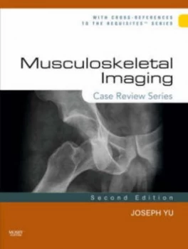 Image of Musculoskeletal Imaging by Joseph Yu Paperback