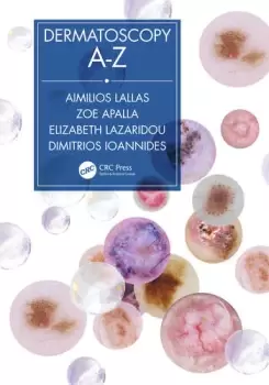 Image of Dermatoscopy A-Z