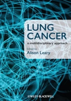 Image of Lung Cancer by Alison Leary Book