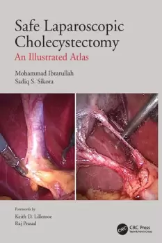 Image of Safe Laparoscopic CholecystectomyAn Illustrated Atlas