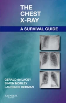 Image of The Chest X-Ray by Gerald De Lacey Paperback