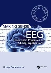 Image of Making Sense of the EEG From Basic Principles to Clinical Applications