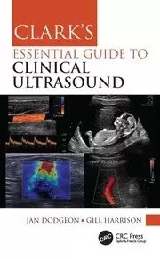 Image of Clark's Essential Guide to Clinical Ultrasound