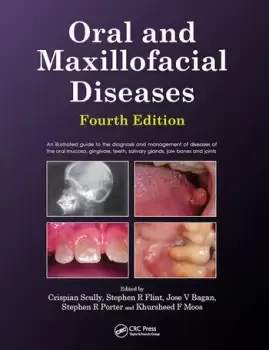 Image of Oral and Maxillofacial Diseases Fourth Edition