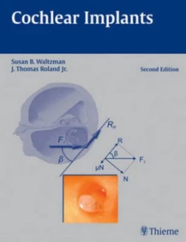Image of Cochlear Implants 2nd Edition by Susan Waltzman Hardback