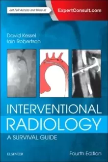 Image of Interventional Radiology: A Survival Guide
