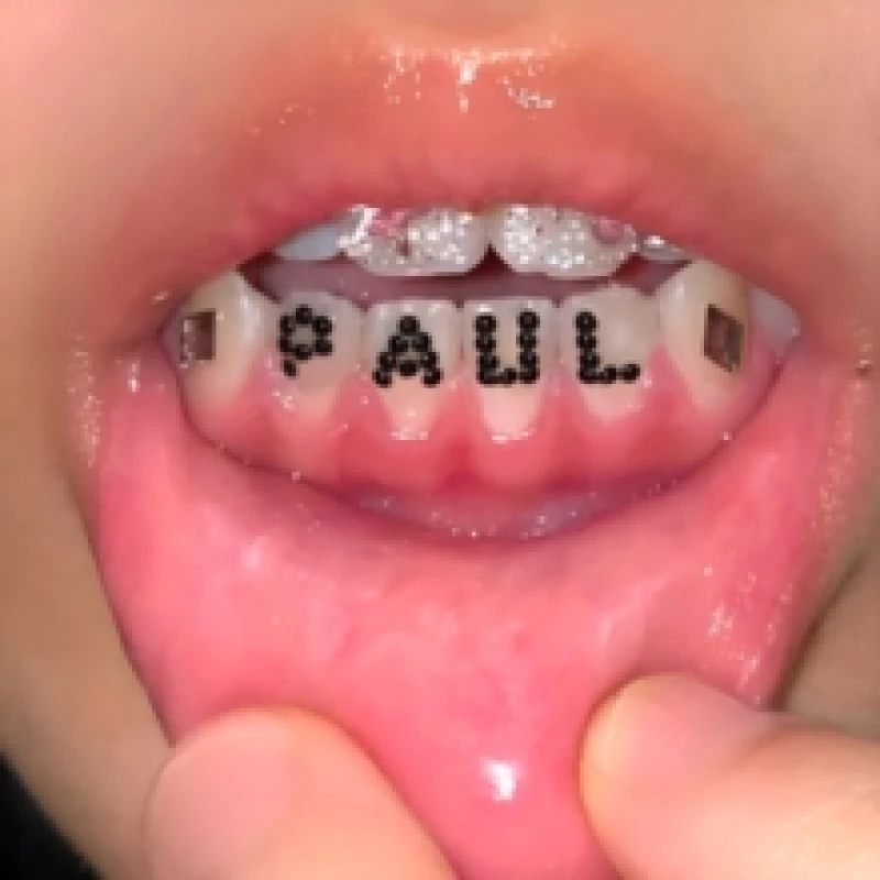 Image of Smiling Through the Pain 2 Vinyl