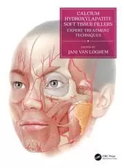 Image of Calcium Hydroxylapatite Soft Tissue Fillers Expert Treatment Techniques