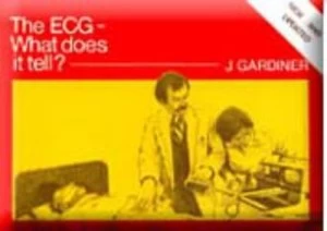 Image of The Ecg - What Does It Tell by J Gardiner Paperback