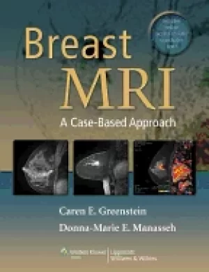 Image of breast mri a case based approach