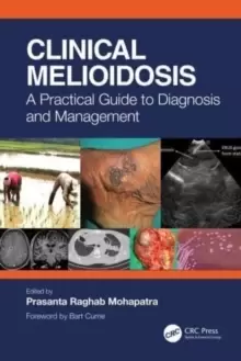 Image of Clinical Melioidosis : A Practical Guide to Diagnosis and Management