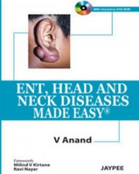 Image of Ent Head and Neck Diseases Made Easy by V Anand Paperback