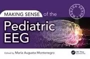 Image of Making Sense of the Pediatric EEG