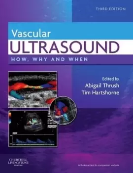 Image of Vascular ultrasound by Abigail Thrush