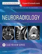 Image of neuroradiology imaging case review