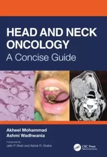 Image of Head and Neck Oncology : A Concise Guide