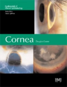 Image of Cornea by Douglas Coster Hardback