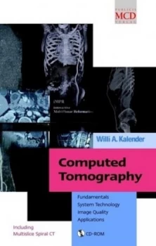 Image of Computed Tomography by Willi A. Kalender Hardback