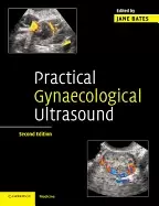 Image of practical gynaecological ultrasound