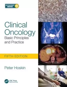 Image of Clinical OncologyBasic Principles and Practice