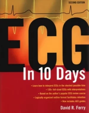 Image of ECG in ten days by David R Ferry