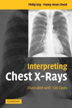 Image of Interpreting Chest X-Rays by Philip Eng Paperback