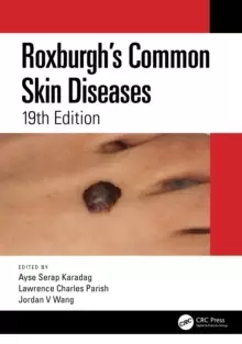 Image of Roxburgh's Common Skin Diseases