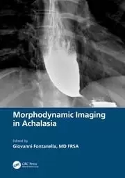 Image of Morphodynamic Imaging in Achalasia