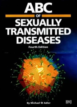 Image of Abc of Sexually Transmitted Diseases by Michael Adler Paperback