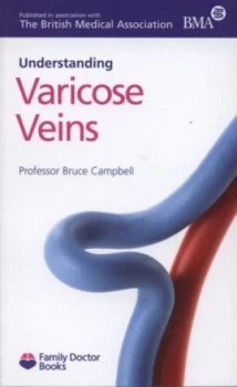 Image of Understanding Varicose Veins by Bruce Campbell Paperback