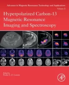 Image of Hyperpolarized Carbon-13 Magnetic Resonance Imaging and Spectroscopy : Volume 3