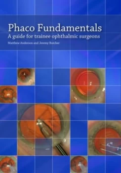 Image of Phaco Fundamentals by Matthew Anderson Book